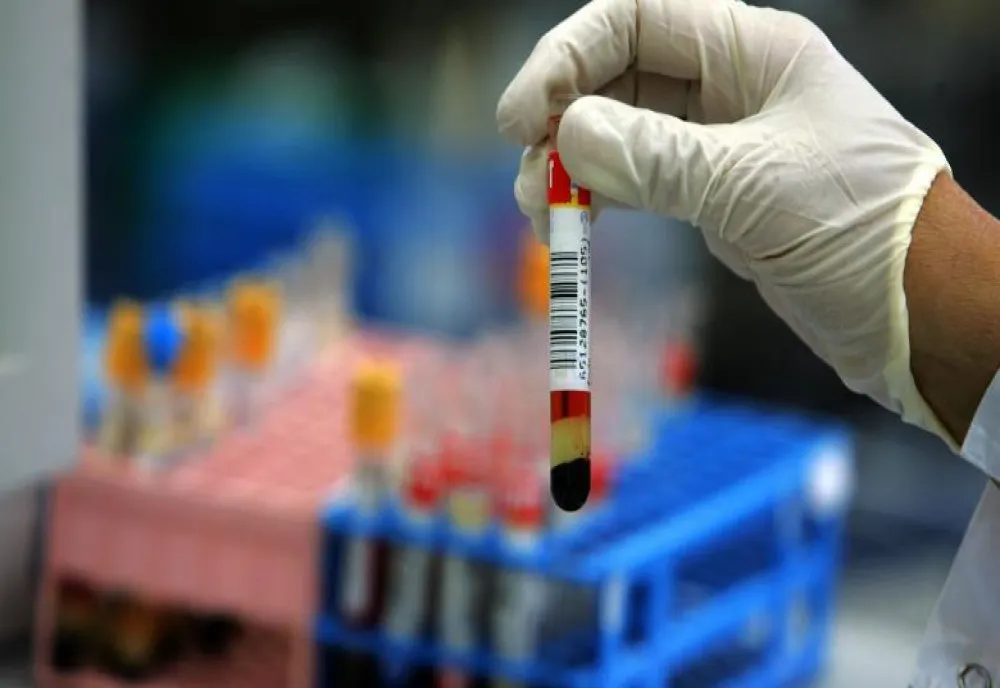  Un test de sânge ar putea detecta cancerul mamar cu cinci ani înaintea primelor simptome 