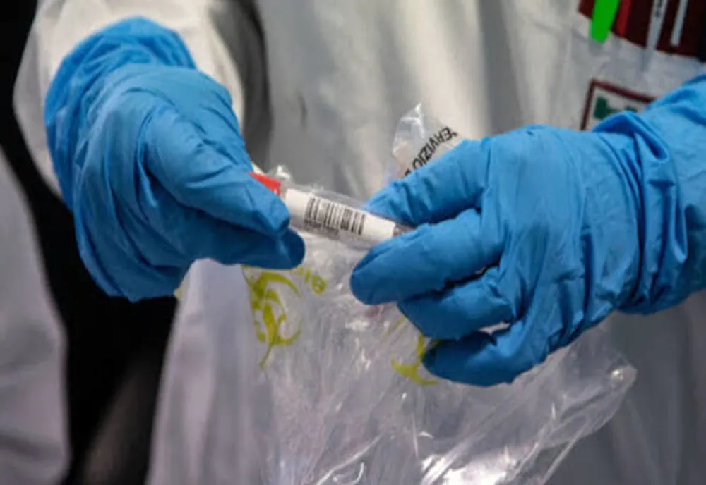Încă 3 decese ale unor persoane infectate cu noul coronavirus. Totalul ajunge la 29. Vezi ultimele cazuri