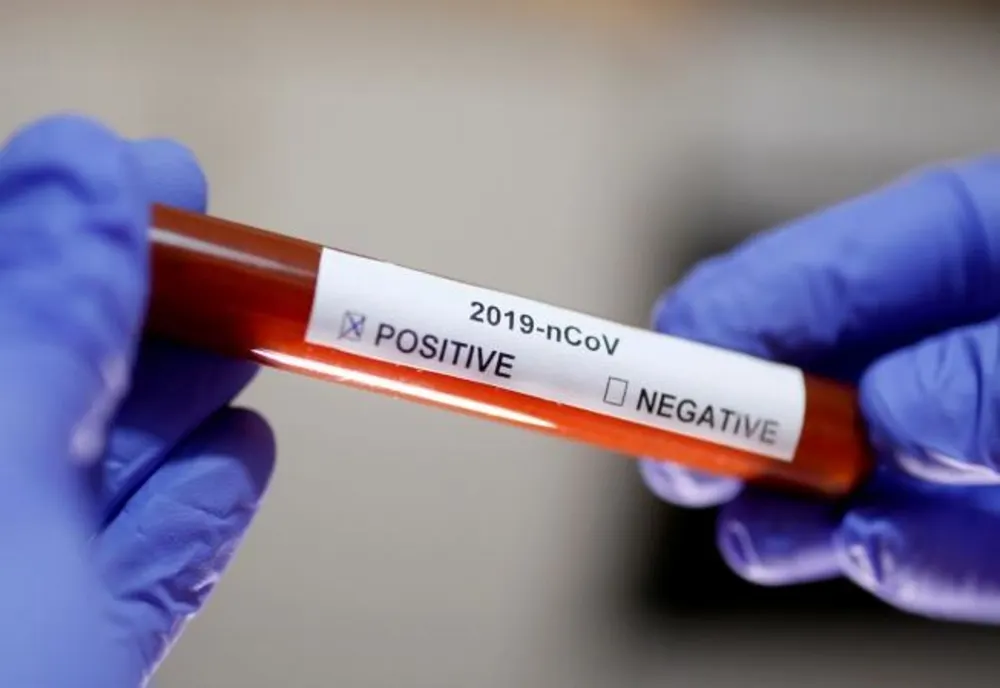 445 decese au avut loc pana astăzi în Romania, din cauza coronavirus