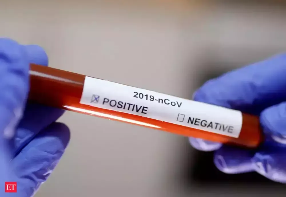 În ultimele 24 de ore s-a înregistrat un deces în cadrul secției Boli Infecțioase a Spitalului Județean Vâlcea, pacient confirmat Covid-19 pozitiv