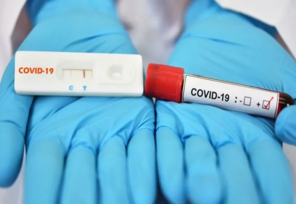 COVID – 19. 431 de noi cazuri de îmbolnăvire în România