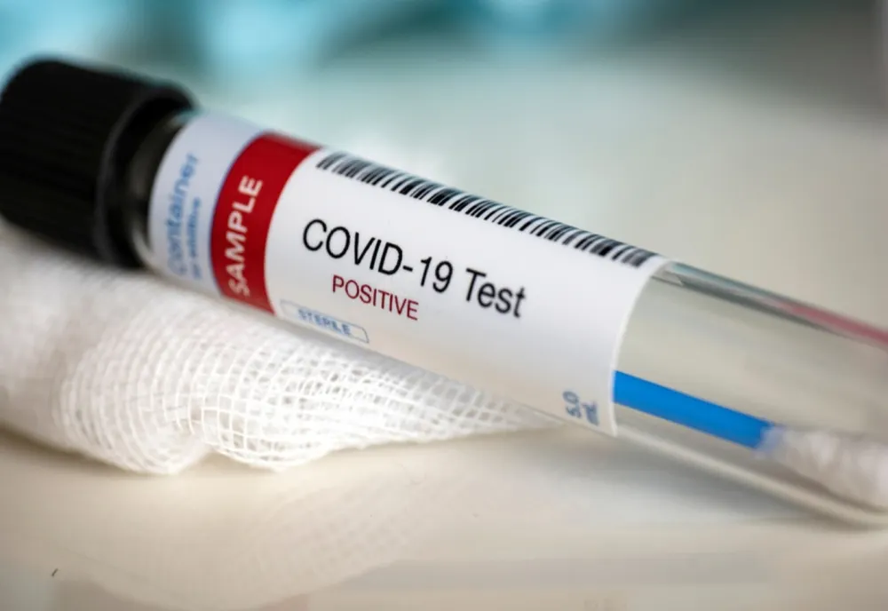 COVID-19. 7733 de cazuri noi în țară. Incidența infectărilor din fiecare județ