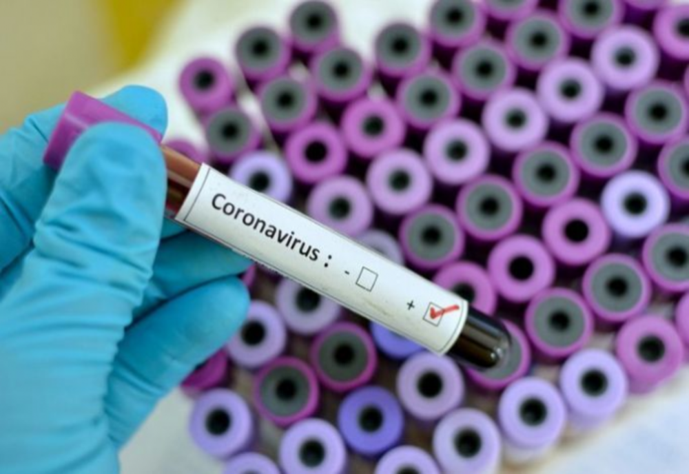 507 decese cauzate de infecție cu coronavirus, în România, anunțate în această dimineață