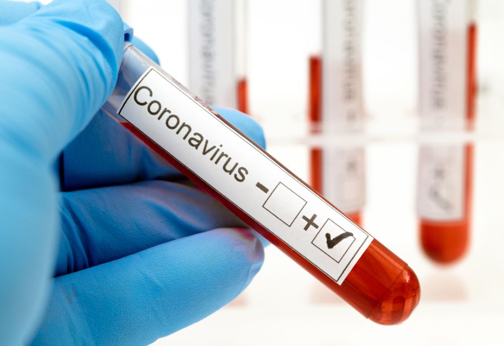 Coronavirus România: încă 213 cazuri noi