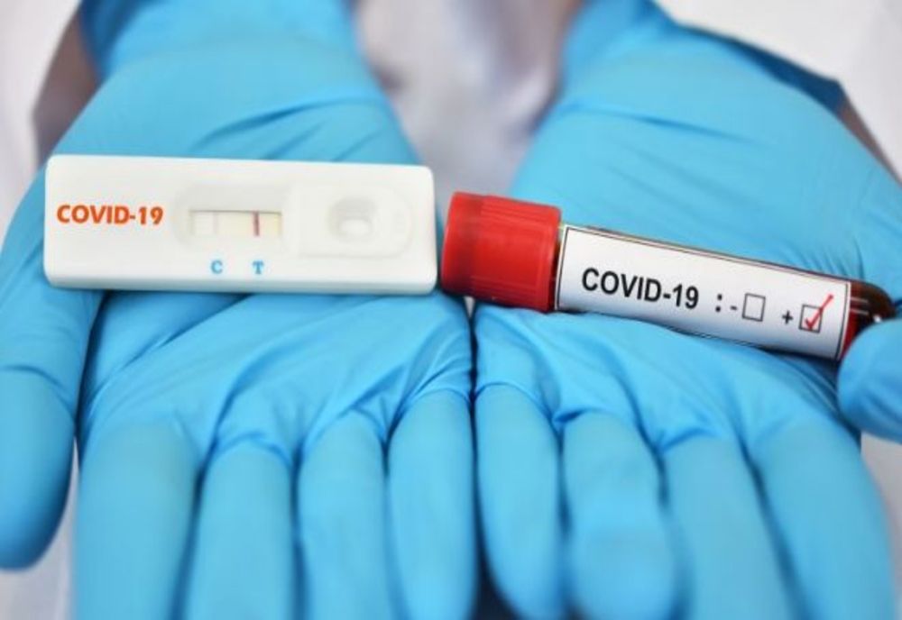 COVID – 19. 431 de noi cazuri de îmbolnăvire în România