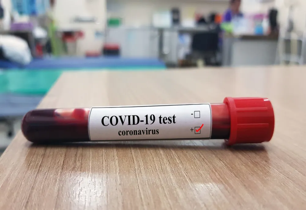 Bilanțul cazurilor de infectare cu coronavirus a urcat, joi, la 277