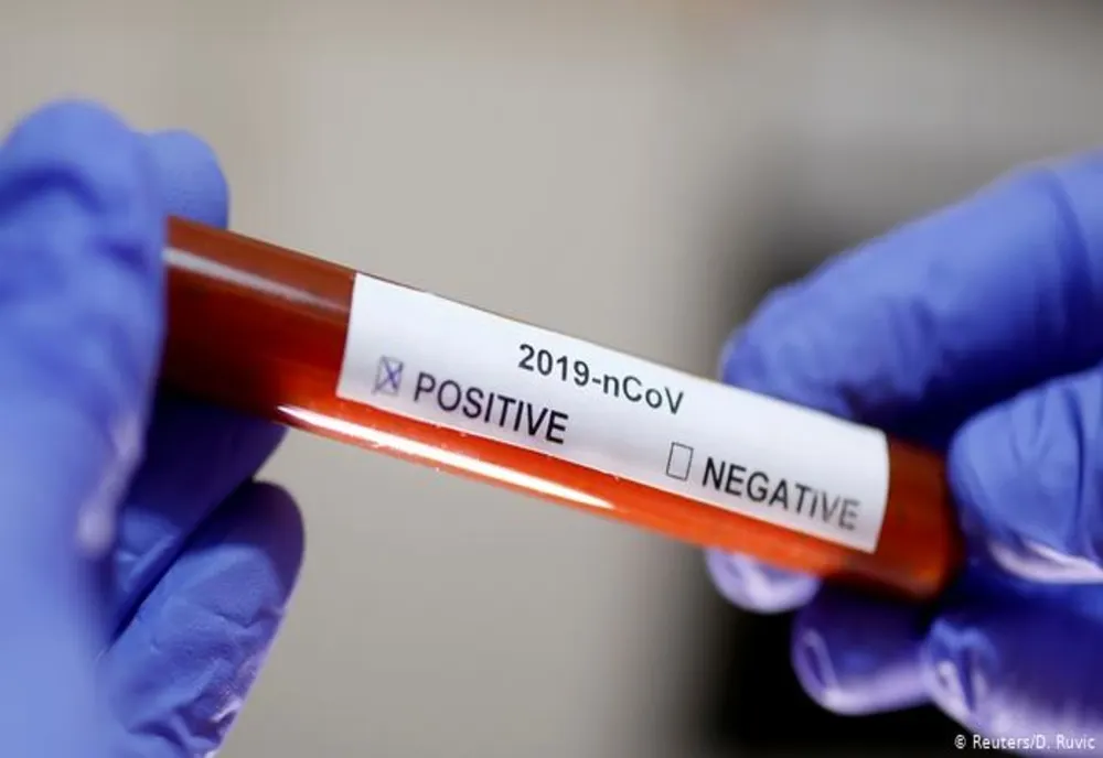 Primul deces la Vâlcea în rândul persoanelor confirmate cu noul coronavirus