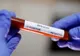 451 decese în Romania din cauza coronavirus. 30 de persoane astăzi 