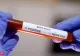 În ultimele 24 de ore s-a înregistrat un deces în cadrul secției Boli Infecțioase a Spitalului Județean Vâlcea, pacient confirmat Covid-19 pozitiv