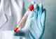 Coronavirus România: scade numărul infecțiilor, 145 de cazuri noi